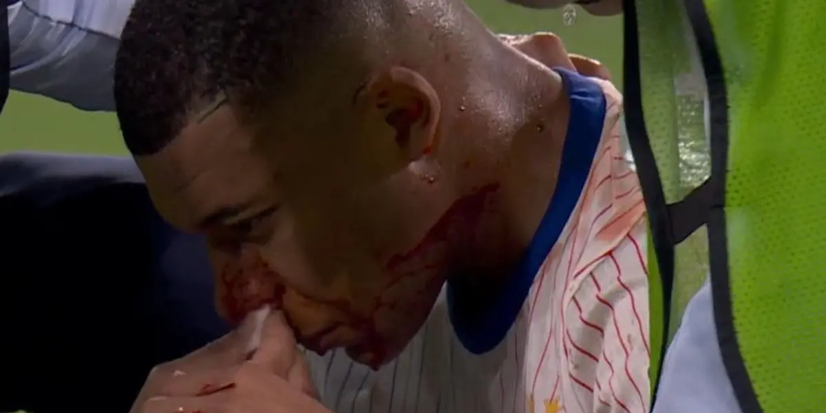 Mbappé sangrando en el partido ante Austria.