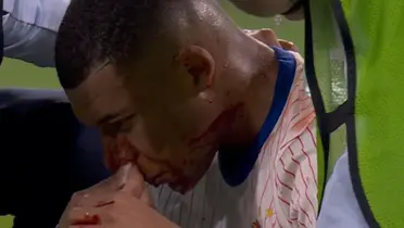 Mbappé sangrando en el partido ante Austria.