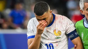 Mbappé sangrando tras su choque contra el hombro del defensor austríaco.