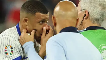 Mbappé siendo revisado por los médicos de Francia tras chocar su nariz contra un defensor austríaco.